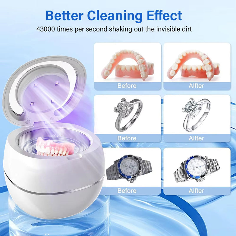 Denturexi V2 Ultrasonic Retainer Cleaner UK