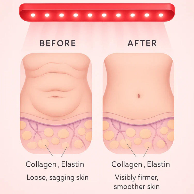Lumeltiz Red Light Therapy Belt For Weight Loss