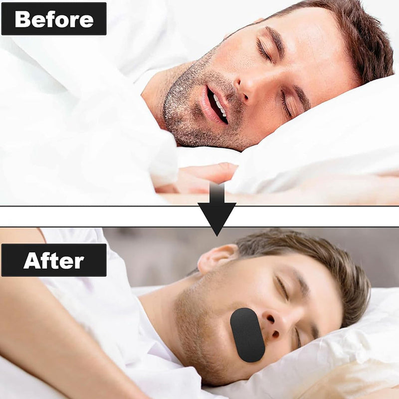 NightyLip Mouth Tape For Sleeping